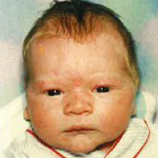 Donor 21254 Photo